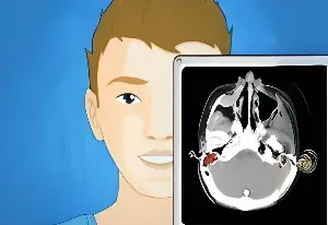 Operate Now: Eardrum Surgery