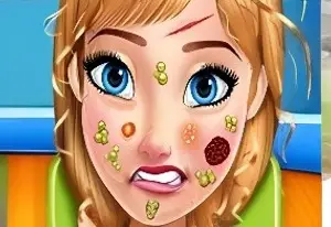 Игра Уход за Лицом Анны