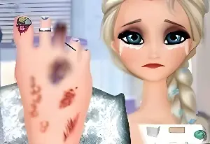 Травма стопы Эльзы